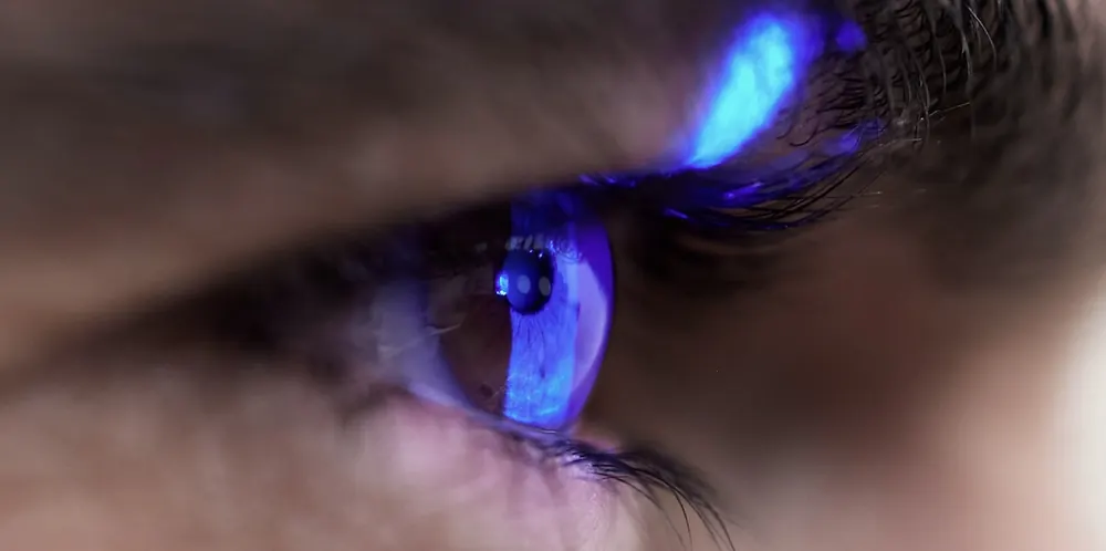 Assessment — Complimentary 60-minute eye assessment. We measure your prescription, corneal shape, and overall eye health.